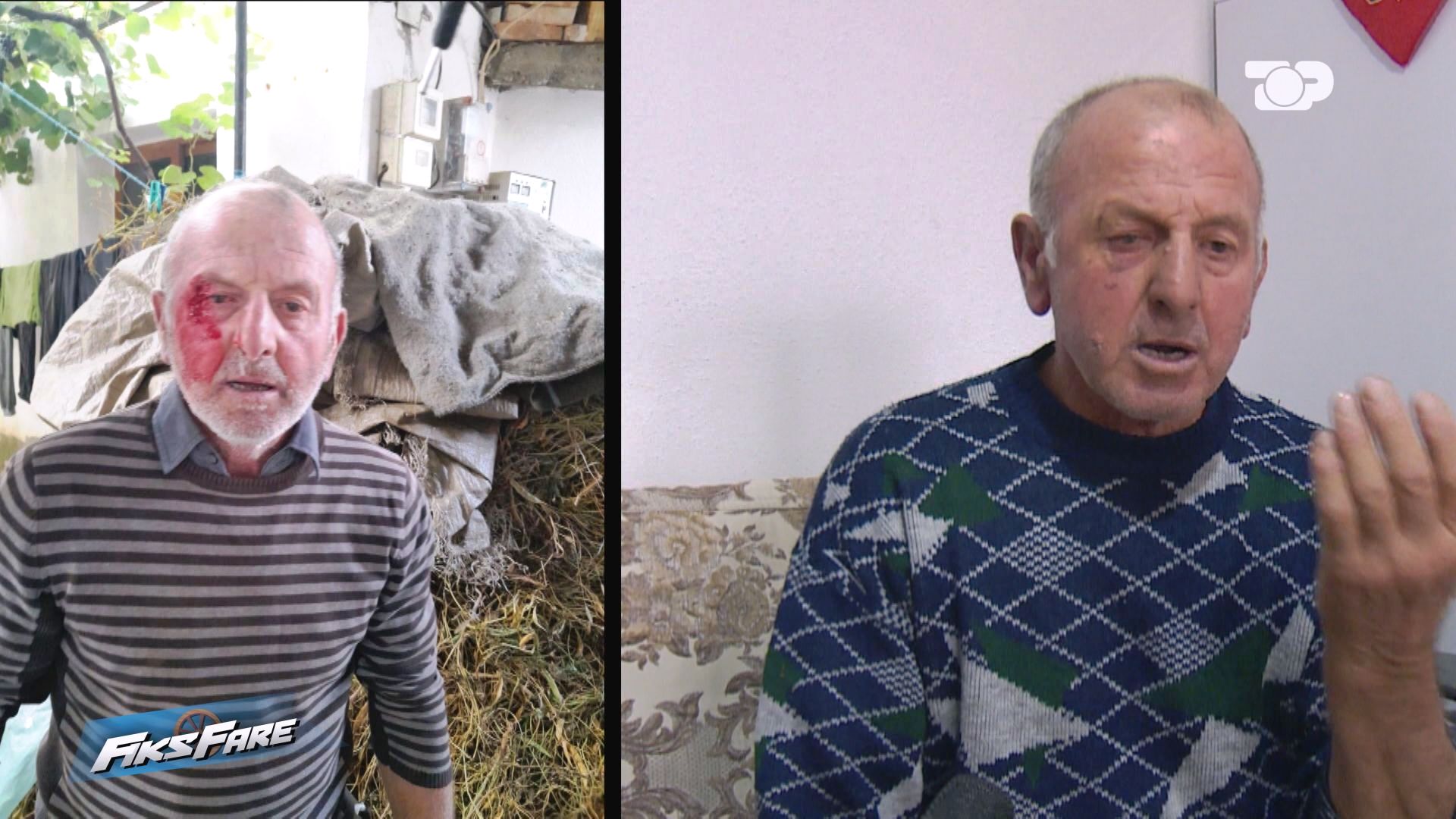 Fiks Fare  Dhunohet familja në Devoll  policia lë të lirë autorin  Mjeku ligjor vonon ekspertimin