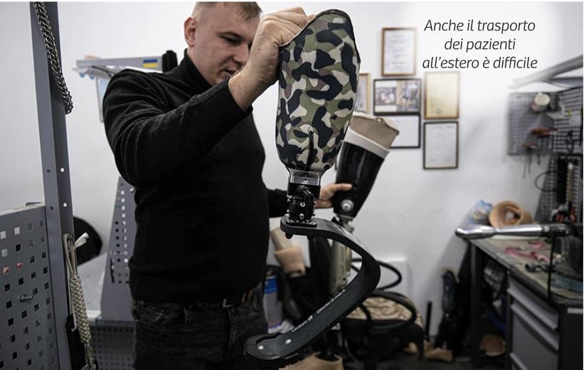 Drama e Ukrainës me 100 mijë persona të amputuar  bëhet  fabrika  më e madhe e protezave në botë