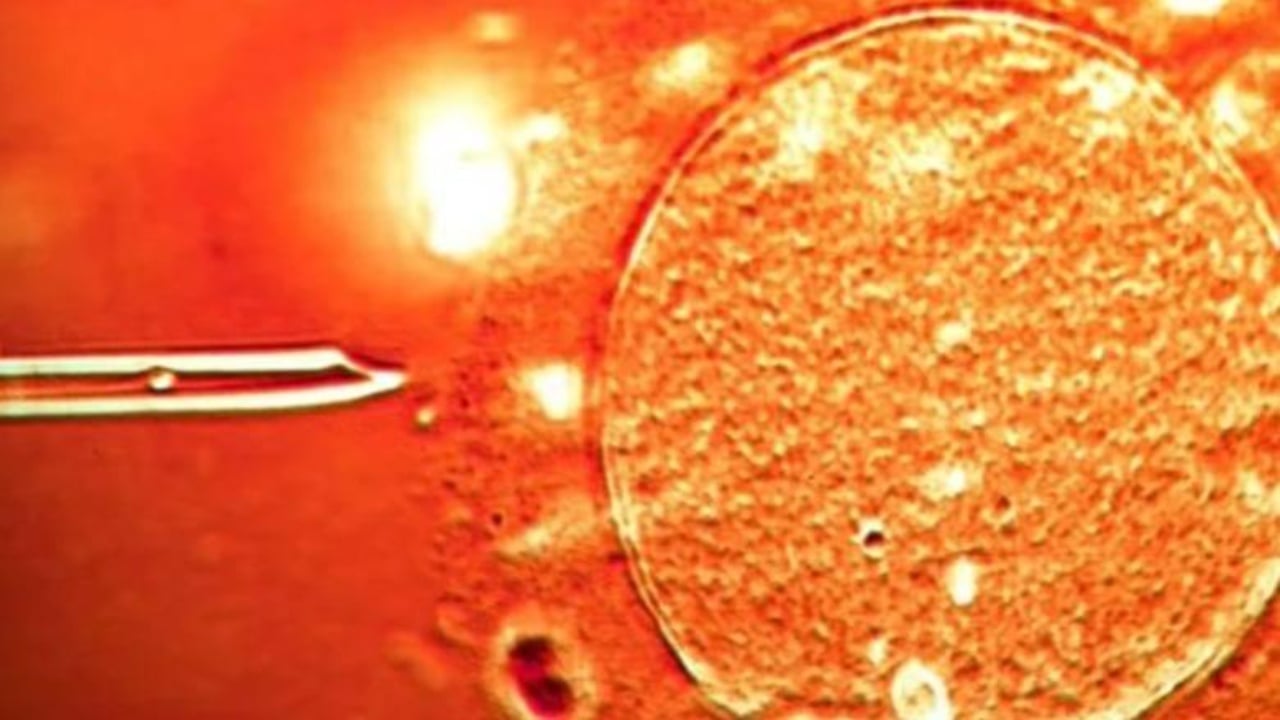 Zbulimi shokues  Në Europë u përdor spermë nga dhurues me kancer  e përfshirë edhe Shqipëria