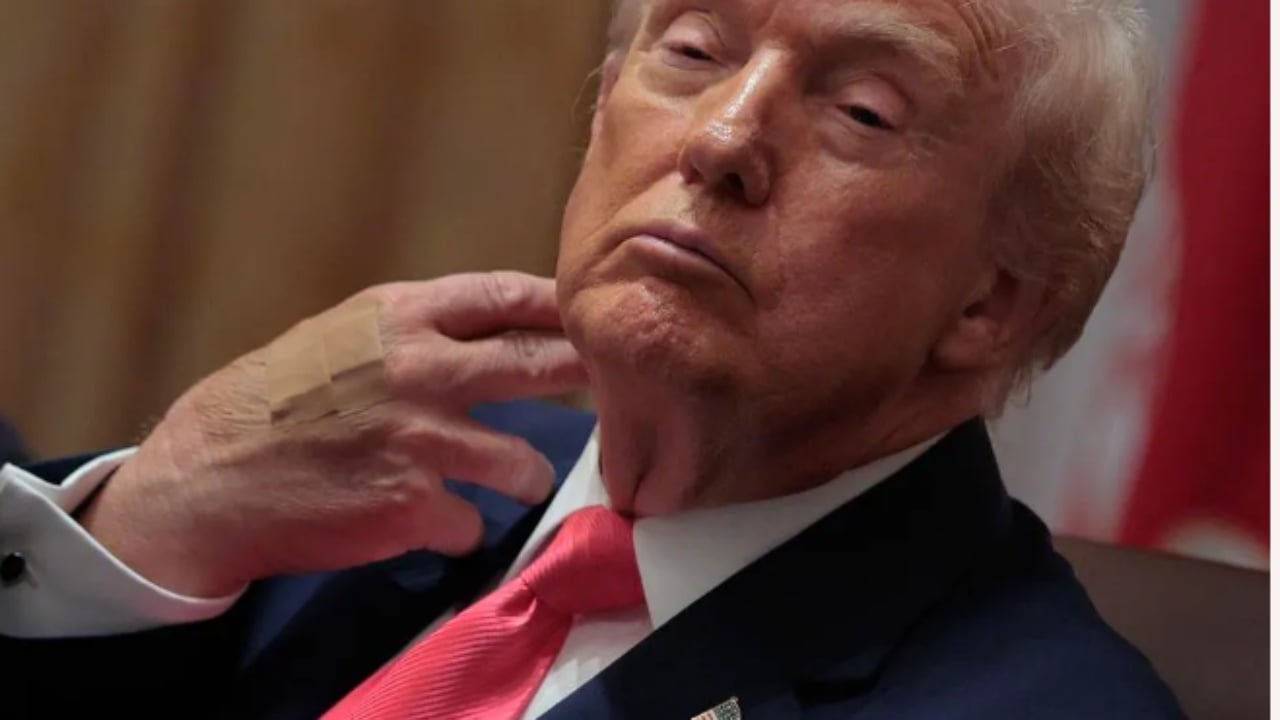 Trump me fasha ngjitëse në duar  Shtëpia e Bardhë  Nuk është i sëmurë