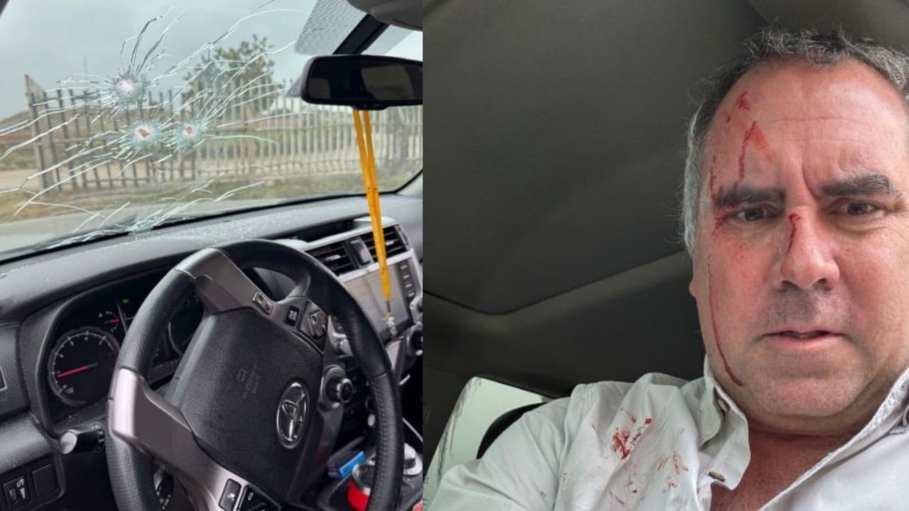 Kandidati për zgjedhjet presidenciale në Peru sulmohet me armë zjarri  publikohen fotot nga atentati