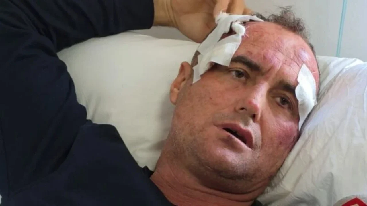  Më dhunuan në shtëpinë time njerëz me uniformën e policisë   reagon sërish 46 vjeçari nga Fieri  Dua drejtësi