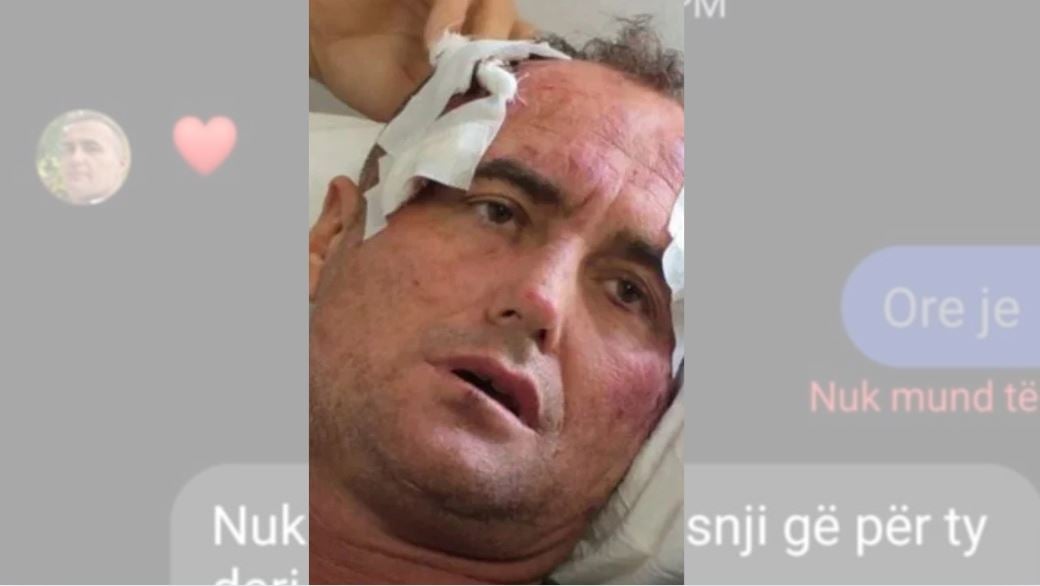  Je më e bukura e fshatit   pas publikimit të mesazheve private  reagon motra e 46 vjeçarit të dhunuar  Mjaft me këtë telenovelë  s kërkojmë hakmarrje por 