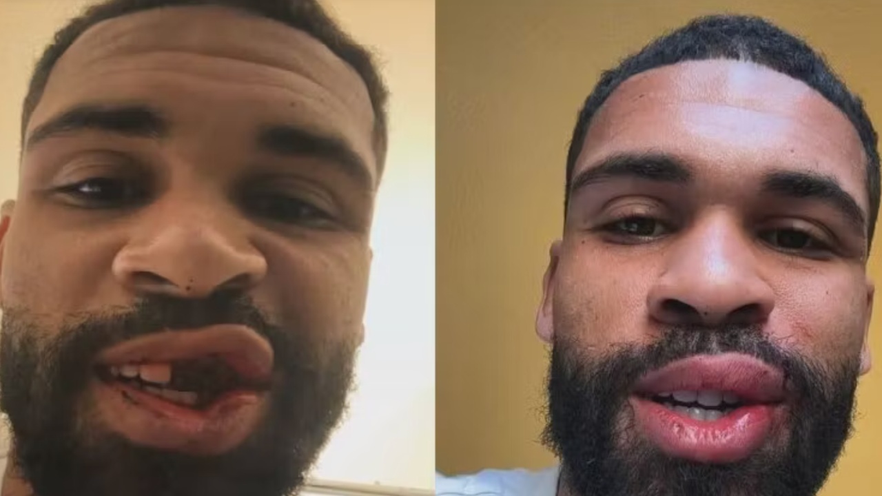 Loftus Cheek publikon veten pa dhëmbë  më pas falenderon të gjithë për mbështetjen  Më e keqja ka kaluar