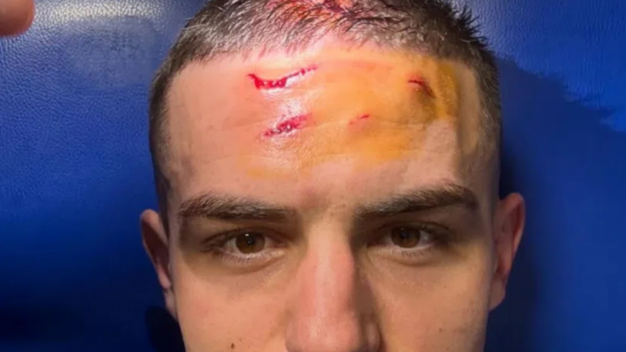 Krstović zbulon shenjat e takave në kokë  që sollën penalltinë në minutat shtesë të ndeshjes  për mrekullinë e Atalantës