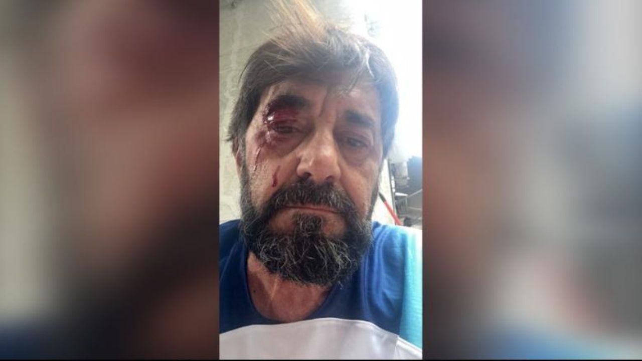 goditja-e-analistit-ilir-demalia-lutfi-dervishi-dhuna-ndaj-nje-njeriu-s-mund-te-relativizohet-te-justifikohet-apo-akoma-me-keq-te-festohet