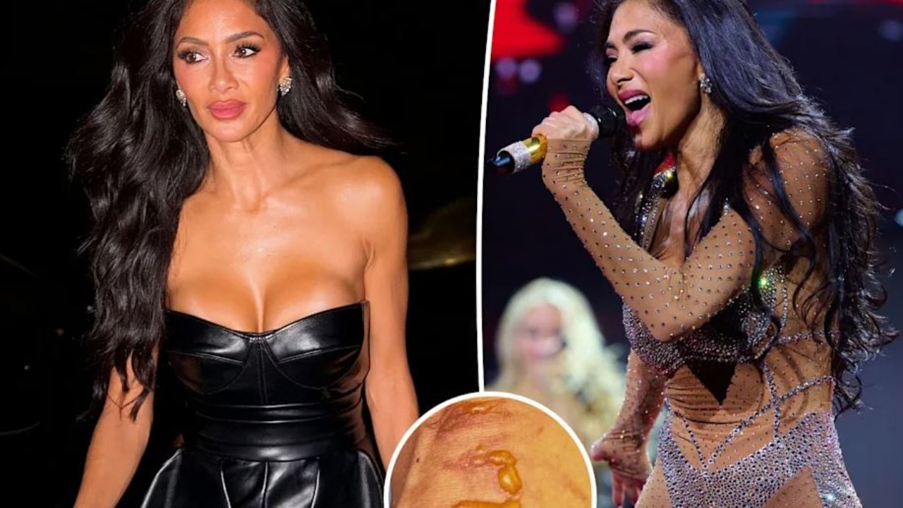 Pësoi djegie të rëndë me ujë të valuar pak para koncertit  Nicole Scherzinger nuk e anuloi performancën