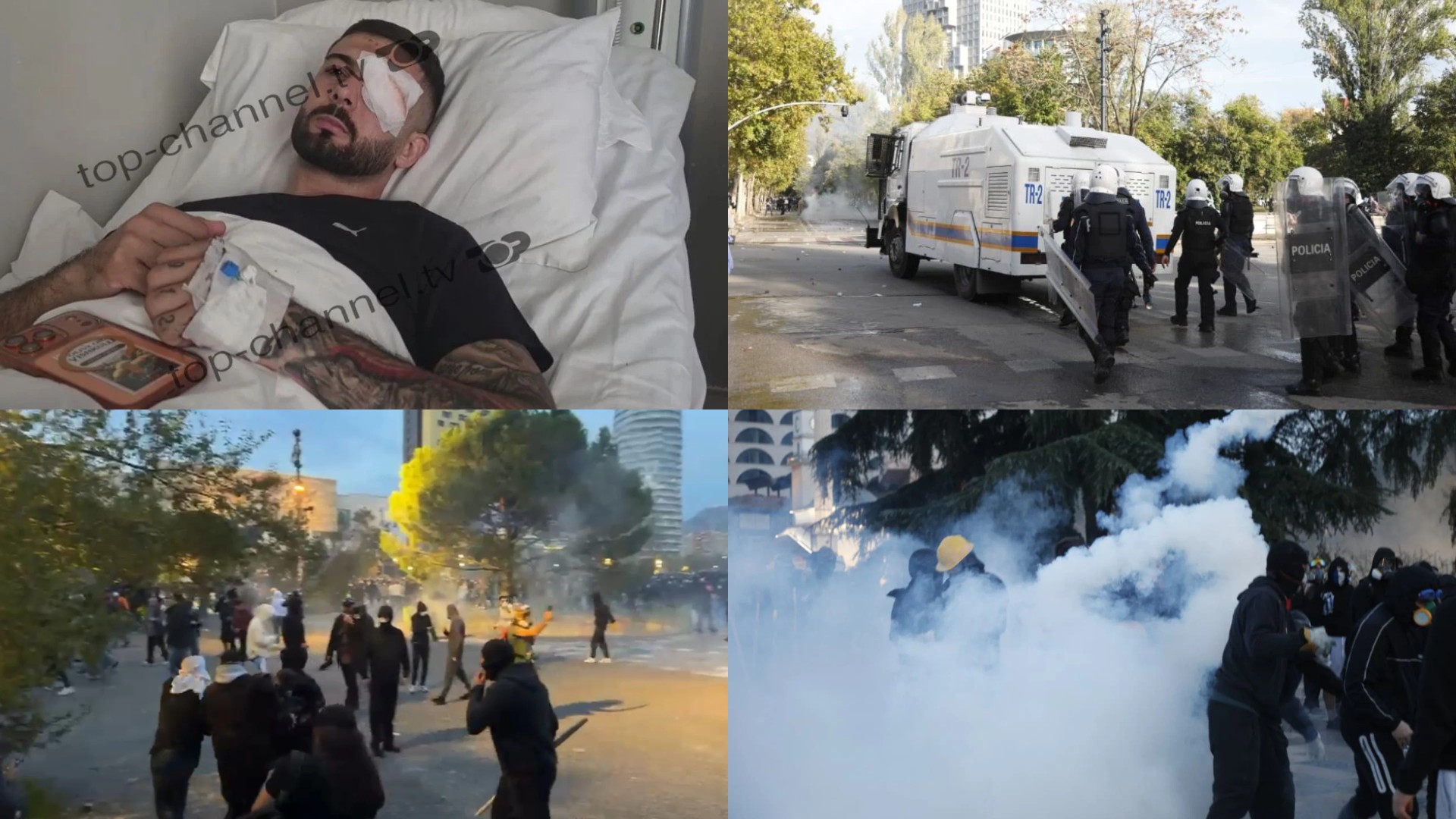 Foto nga burimi: U lëndua në sy gjatë protestës, sekuestrohen pamjet e kamerave të sigurisë për Erjon Vishkullin/ Prokuroria e Tiranës nis hetime ndaj policisë