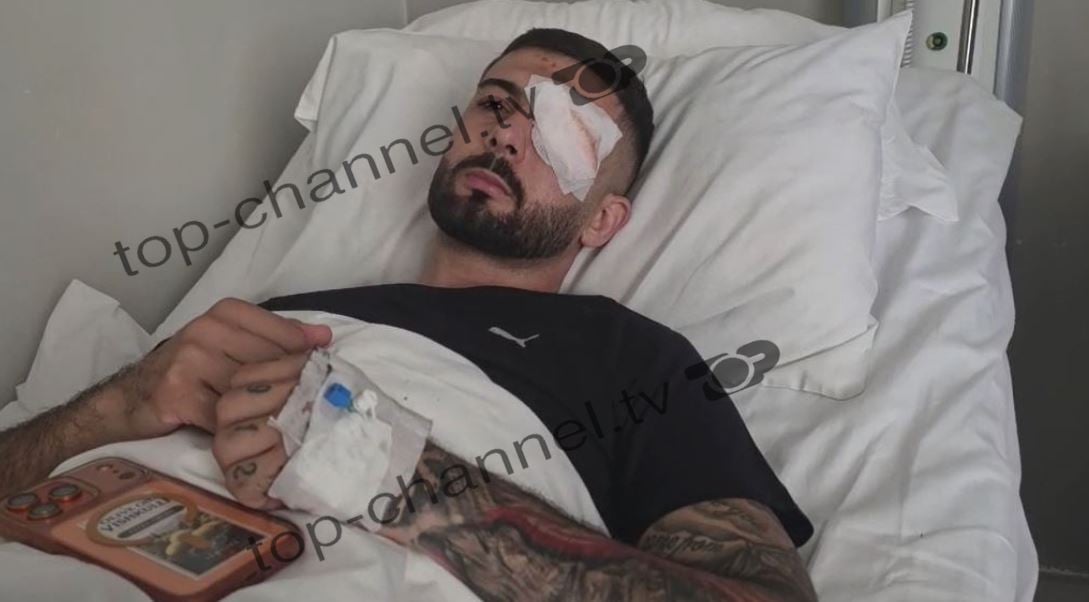 Ekskluzive   Plumbin e kam ende në sy   para nisjes drejt Italisë  rrëfehet 28 vjeçari që u plagos në protestë  Isha 30 metra larg efektivëve  po rrija pa asnjë reagim