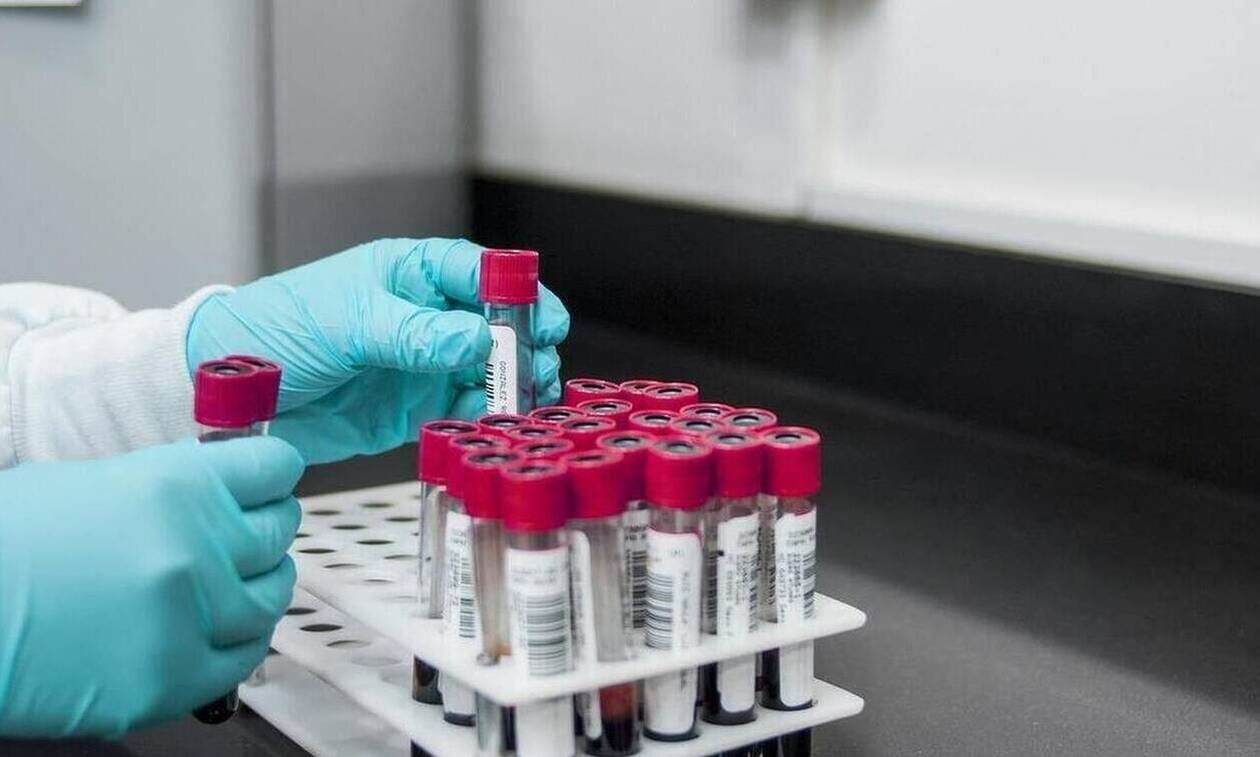 Raportohet vdekja e dytë nga murtaja në spitalin e karantinës në Siberi  rritet alarmi