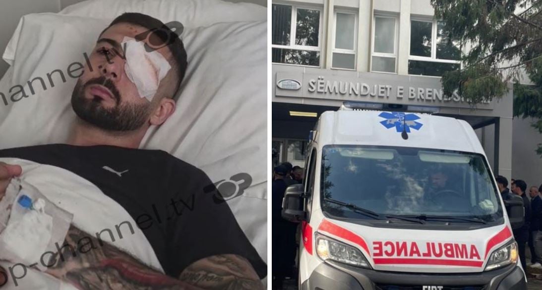“Kemi shenja pozitive”, niset drejt Italisë 28-vjeçari që u plagos me plumb në sy dje, shefja e okulistikës: Do t’i nënshtrohet atje ndërhyrjes